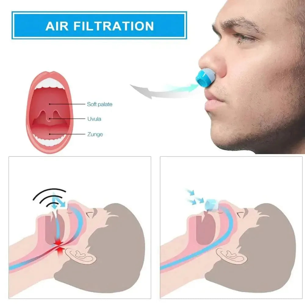 🔥LAST DAY 49% OFF-Micro Machine For Sleep Apnea | Cpap Anti Snoring Device